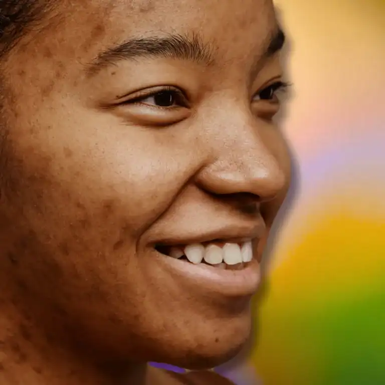 Benefits Of Rosemary Oil For Acne-Prone Skin